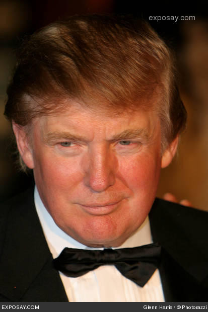 donald trump without toupee. NO DREDS here either,